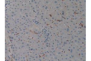 IHC-P analysis of Human Liver Tissue, with DAB staining. (AIF 抗体  (AA 103-322))