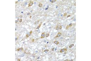 Immunohistochemistry of paraffin-embedded rat brain using HSPA6 antibody. (HSPA6 抗体  (AA 474-643))