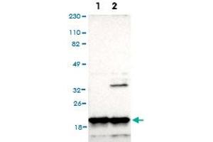 Western Blot analysis of (1) Human RT-4 cell, (2) Human U-251MG sp cell. (NDUFB8 抗体)