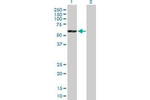Western Blot analysis of ATP6V1B2 expression in transfected 293T cell line by ATP6V1B2 MaxPab polyclonal antibody. (ATP6V1B2 抗体  (AA 1-511))