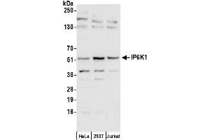 Western Blotting (WB) image for anti-Inositol Hexakisphosphate Kinase 1 (IP6K1) (AA 75-125) antibody (ABIN7452849)