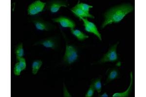 Immunofluorescence staining of U251 cells with ABIN7175751 at 1:166, counter-stained with DAPI. (WDR41 抗体  (AA 7-284))