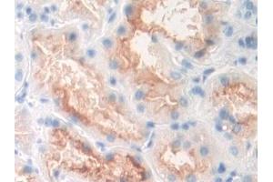Immunohistochemistry (IHC) image for anti-Folate Hydrolase (Prostate-Specific Membrane Antigen) 1 (FOLH1) (AA 274-587) antibody (ABIN7443569)