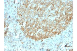 Formalin-fixed, paraffin-embedded human Tonsil stained with MALT1 Recombinant Mouse Monoclonal Antibody (rMT1/410).