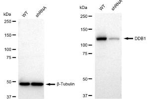 Western blotting analysis using DDB1 antibody (ABIN7798273). (Recombinant DDB1 抗体)