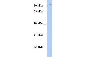 TRPC4AP antibody used at 1 ug/ml to detect target protein. (TRPC4AP 抗体  (Middle Region))