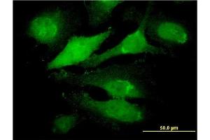Immunofluorescence (IF) image for anti-Ring Finger Protein 144B (RNF144B) (AA 1-100) antibody (ABIN531470)