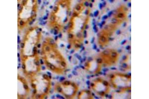 Used in DAB staining on fromalin fixed paraffin-embedded Kidney tissue (Latexin 抗体  (AA 1-222))