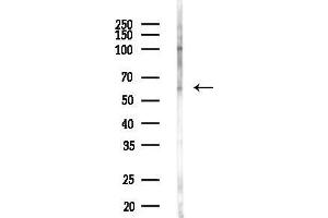 Western blot analysis of lysates from HUVEC cells(LPC4h treatment), using LGALS3BP Antibody at 1/1000 dilution.