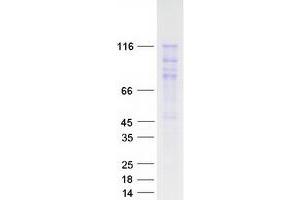 Validation with Western Blot (CTNND1 Protein (Transcript Variant 1) (Myc-DYKDDDDK Tag))