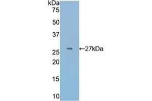 Detection of Recombinant CYR61, Mouse using Polyclonal Antibody to Cysteine Rich Protein, Angiogenic Inducer 61 (CYR61) (CYR61 抗体  (AA 176-379))