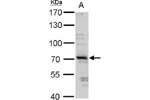WB Image TRIM32 antibody detects TRIM32 protein by western blot analysis. (TRIM32 抗体)