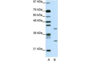 WB Suggested Anti-ZFP36L1 Antibody Titration: 1. (ZFP36L1 抗体  (N-Term))