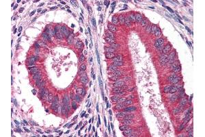 Immunohistochemical analysis of paraffin-embedded human Uterus tissues using anFtEG mouse mAb (EGF 抗体)