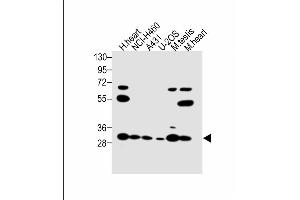 Western Blotting (WB) image for anti-Voltage-Dependent Anion Channel 3 (VDAC3) (AA 156-183) antibody (ABIN1537893)