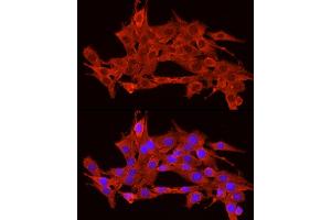 Immunofluorescence analysis of PC-12 cells using POMC Rabbit pAb (ABIN3017230, ABIN3017231, ABIN3017232 and ABIN6220004) at dilution of 1:200 (40x lens). (POMC 抗体  (AA 1-267))