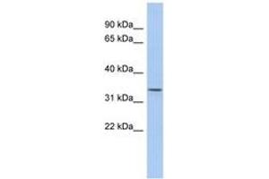 anti-Zinc Finger, DHHC-Type Containing 24 (ZDHHC24) (AA 35-84) antibody