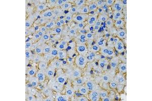 Immunohistochemistry of paraffin-embedded rat liver using RAF1 antibody. (RAF1 抗体)