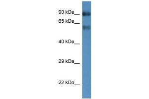 WB Suggested Anti-Slc6a15 Antibody   Titration: 1. (SLC6A15 抗体  (Middle Region))