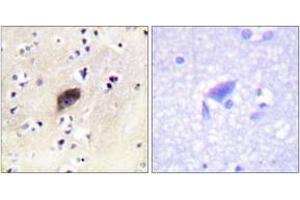 Immunohistochemistry analysis of paraffin-embedded human brain, using PAK1/2/3 (Phospho-Ser144/141/139) Antibody. (PAK1/2/3 抗体  (pSer144))