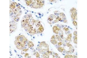 Immunohistochemistry (Paraffin-embedded Sections) (IHC (p)) image for anti-Phosphatidylinositol-5-Phosphate 4-Kinase, Type II, beta (PIP4K2B) antibody (ABIN7264077)