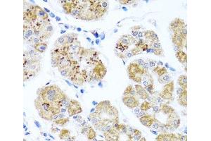Immunohistochemistry of paraffin-embedded Human stomach using PIP4K2B Polyclonal Antibody at dilution of 1:100 (40x lens). (PIP4K2B 抗体)