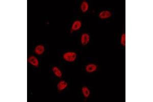 ABIN6274686 staining A549 by IF/ICC. (Exonuclease 1 抗体  (N-Term))