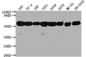 Western Blot Positive WB detected in: U87 whole cell lysate, PC-3 whole cell lysate, 293 whole cell lysate, U251 whole cell lysate, A549 whole cell lysate, A375 whole cell lysate, MG-63 whole cell lysate, SH-SY5Y whole cell lysate, All lanes: TUBA1A antibody at 1:5000 Secondary Goat polyclonal to Mouse IgG at 1/10000 dilution Predicted band size: 52 kDa Observed band size: 52 kDa (TUBA1A 抗体)