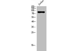 Western Blot analysis of Jurkat cells using Nox5 Polyclonal Antibody (NOX5 抗体  (C-Term))