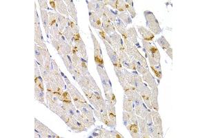 Immunohistochemistry of paraffin-embedded mouse heart using DSP antibody.