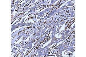 IHC analysis of Hsp47/SERPINH1 using anti-Hsp47/SERPINH1 antibody (ABIN3043331). (SERPINH1 抗体  (AA 247-418))
