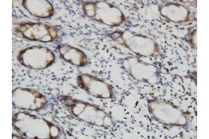 Immunostaining (ISt) image for anti-V-Ral Simian Leukemia Viral Oncogene Homolog B (Ras Related, GTP Binding Protein) (Ralb) (AA 89-183) antibody (ABIN519627)