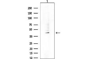 Western blot analysis of lysates from EC304 cells(heat-shock treatment), using SERPIN Antibody at 1/1000 dilution.