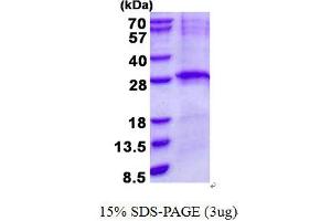 Lin-7 Homolog B (LIN7B) (AA 1-207) protein (His tag)