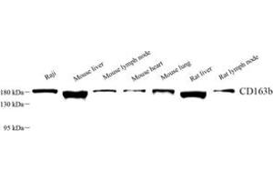 Western blot analysis of CD163b (ABIN7073371) at dilution of 1: 1000 (CD163L1 抗体)