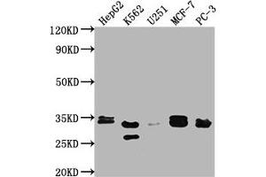 Western Blot Positive WB detected in: HepG2 whole cell lysate, K562 whole cell lysate, U251 whole cell lysate, MCF-7 whole cell lysate, PC-3 whole cell lysate All lanes: RPIA antibody at 1:2000 Secondary Goat polyclonal to rabbit IgG at 1/50000 dilution Predicted band size: 34 kDa Observed band size: 33 kDa (Ribose 5-Phosphate Isomerase A (RPIA) (AA 1-311) 抗体)