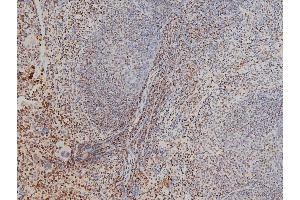 Immunohistochemistry (IHC) image for anti-Cofilin 1 (CFL1) (pSer3) antibody (ABIN6255180)