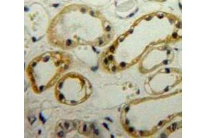 IHC-P analysis of Kidney tissue, with DAB staining. (LIMS1 抗体  (AA 68-303))