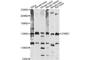 Western blot analysis of extracts of various cell lines, using CAND1 antibody (ABIN6291857) at 1:1000 dilution. (CAND1 抗体)