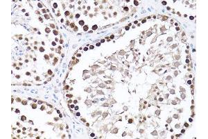 Immunohistochemistry (Paraffin-embedded Sections) (IHC (p)) image for anti-Proliferating Cell Nuclear Antigen (PCNA) (AA 1-261) antibody (ABIN3020826)