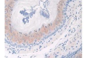 Used in DAB staining on fromalin fixed paraffin- embedded esophagus tissue (CFP 抗体  (AA 54-217))