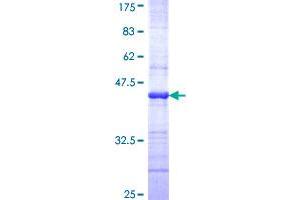 ERN1 Protein (AA 401-500) (GST tag)