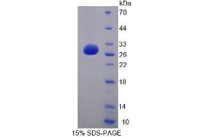 Image no. 1 for Cell Division Cycle 27 Homolog (S. Cerevisiae) (CDC27) (AA 17-231) protein (T7 tag,His tag) (ABIN6239558)