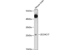 Western blot analysis of extracts of mouse brain, using ZCCHC17 antibody (ABIN7271546) at 1:1000 dilution. (ZCCHC17 抗体  (AA 1-241))