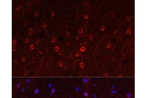 Immunofluorescence (IF) image for anti-Solute Carrier Family 1 (Neuronal/epithelial High Affinity Glutamate Transporter, System Xag), Member 1 (SLC1A1) antibody (ABIN7260717)