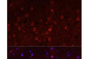 Immunofluorescence analysis of Rat brain using SLC1A1 Polyclonal Antibody at dilution of 1:100. (SLC1A1 抗体)
