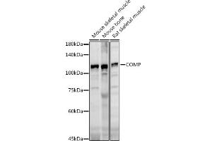 Western blot analysis of extracts of various cell lines, using COMP antibody (ABIN6127650, ABIN6138864, ABIN6138866 and ABIN6221502) at 1:1000 dilution. (COMP 抗体  (AA 20-160))