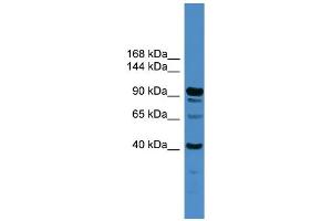 WB Suggested Anti-IFT88  Antibody Titration: 0. (IFT88 抗体  (Middle Region))