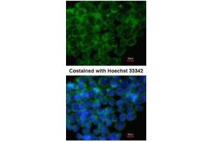 ICC/IF Image Immunofluorescence analysis of methanol-fixed mouse ESC, using IRF6, antibody at 1:100 dilution. (IRF6 抗体  (C-Term))