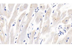 Detection of IGFBP2 in Porcine Cardiac Muscle Tissue using Polyclonal Antibody to Insulin Like Growth Factor Binding Protein 2 (IGFBP2)